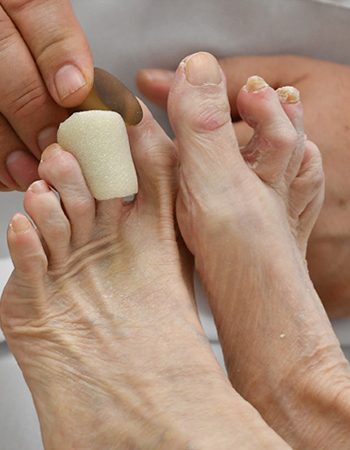 Imagen que muestra las uñas de los pies tratadas por Ines Podologa Geriatrica